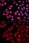 Protein TBRG4 antibody, GTX55813, GeneTex, Immunocytochemistry image 