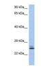RAB15, Member RAS Oncogene Family antibody, NBP1-58898, Novus Biologicals, Western Blot image 