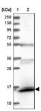 RNA Guanine-7 Methyltransferase Activating Subunit antibody, NBP1-88436, Novus Biologicals, Western Blot image 
