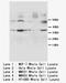 Cyclin D1 antibody, LS-C172074, Lifespan Biosciences, Western Blot image 