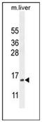 Complexin 3 antibody, AP51051PU-N, Origene, Western Blot image 