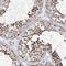 SDE2 Telomere Maintenance Homolog antibody, HPA031256, Atlas Antibodies, Immunohistochemistry frozen image 
