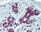 Matrix Metallopeptidase 2 antibody, 51-332, ProSci, Immunohistochemistry paraffin image 