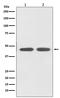 Angiotensin II type-1 receptor antibody, M01213, Boster Biological Technology, Western Blot image 