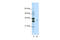 Serine And Arginine Rich Splicing Factor 1 antibody, 29-395, ProSci, Western Blot image 