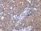 Zinc finger protein 395 antibody, orb524258, Biorbyt, Immunohistochemistry paraffin image 