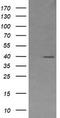 Mitogen-Activated Protein Kinase Kinase 3 antibody, TA505841S, Origene, Western Blot image 