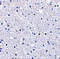 TP53 Induced Glycolysis Regulatory Phosphatase antibody, 4049, ProSci, Immunohistochemistry paraffin image 