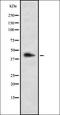 Lim3 antibody, orb337218, Biorbyt, Western Blot image 