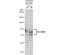 Gibbon ape leukemia virus receptor 1 antibody, NBP1-32252, Novus Biologicals, Western Blot image 