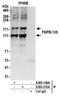 FKBP15 antibody, A300-210A, Bethyl Labs, Immunoprecipitation image 