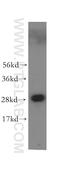 Vesicle Transport Through Interaction With T-SNAREs 1A antibody, 12354-1-AP, Proteintech Group, Western Blot image 
