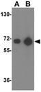 VGF Nerve Growth Factor Inducible antibody, GTX85398, GeneTex, Western Blot image 