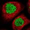 Aprataxin And PNKP Like Factor antibody, NBP2-38212, Novus Biologicals, Immunocytochemistry image 