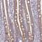 Mitochondrial Ribosomal Protein S2 antibody, HPA057261, Atlas Antibodies, Immunohistochemistry frozen image 