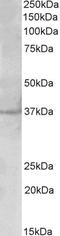 Serine/threonine-protein kinase PLK5 antibody, STJ72977, St John