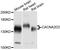 Calcium Voltage-Gated Channel Auxiliary Subunit Alpha2delta 2 antibody, A10267, ABclonal Technology, Western Blot image 