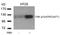 Protein Tyrosine Kinase 2 antibody, AP09494PU-N, Origene, Western Blot image 