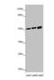 Cerebellar Degeneration Related Protein 2 antibody, orb238325, Biorbyt, Western Blot image 