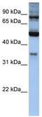 Inositol Polyphosphate-5-Phosphatase B antibody, TA335095, Origene, Western Blot image 