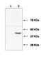 Ubiquitin Conjugating Enzyme E2 J1 antibody, orb345578, Biorbyt, Western Blot image 