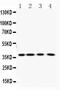 Purine Nucleoside Phosphorylase antibody, A00988-1, Boster Biological Technology, Western Blot image 