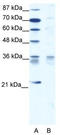 BARX Homeobox 1 antibody, TA331790, Origene, Western Blot image 