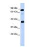 BCAP29, CT antibody, NBP1-62732, Novus Biologicals, Western Blot image 