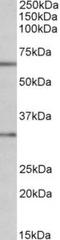 Caspase 3 antibody, TA311292, Origene, Western Blot image 