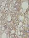 MTHFD1 antibody, FNab05401, FineTest, Immunohistochemistry frozen image 