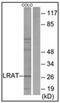 Lecithin retinol acyltransferase antibody, AP32252PU-N, Origene, Western Blot image 