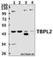 TATA box-binding protein-like protein 2 antibody, A13241-1, Boster Biological Technology, Western Blot image 