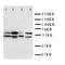 Serine Palmitoyltransferase Long Chain Base Subunit 1 antibody, orb76290, Biorbyt, Western Blot image 