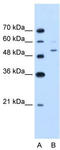 PBEF antibody, TA346416, Origene, Western Blot image 
