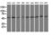 Proteasome 26S Subunit, ATPase 3 antibody, M07208-1, Boster Biological Technology, Western Blot image 