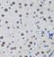 Metastasis Associated 1 Family Member 3 antibody, FNab05390, FineTest, Immunohistochemistry paraffin image 