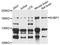 EH domain-binding protein 1 antibody, STJ111640, St John