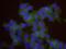 Minichromosome Maintenance Complex Component 3 antibody, GTX24460, GeneTex, Proximity Ligation Assay image 