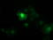 Catenin Beta 1 antibody, LS-C172669, Lifespan Biosciences, Immunofluorescence image 