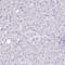 Zymogen granule membrane protein 16 antibody, HPA052066, Atlas Antibodies, Immunohistochemistry paraffin image 