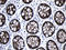 Villin 1 antibody, LS-C797008, Lifespan Biosciences, Immunohistochemistry paraffin image 