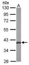 Crystallin Zeta antibody, GTX118270, GeneTex, Western Blot image 