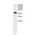 Dual Specificity Phosphatase 10 antibody, NB100-888, Novus Biologicals, Western Blot image 
