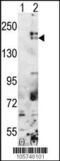 SET Domain Bifurcated Histone Lysine Methyltransferase 1 antibody, 55-382, ProSci, Western Blot image 