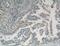 Cyclin D3 antibody, 66357-1-Ig, Proteintech Group, Immunohistochemistry paraffin image 