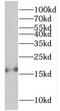 Retinol Binding Protein 5 antibody, FNab07193, FineTest, Western Blot image 