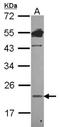 Lipocalin 1 antibody, NBP2-19362, Novus Biologicals, Western Blot image 