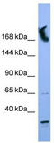 Nucleoporin 155 antibody, TA335751, Origene, Western Blot image 