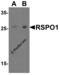 R-Spondin 1 antibody, 5171, ProSci Inc, Western Blot image 