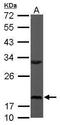Ribosomal Protein S10 antibody, TA307999, Origene, Western Blot image 